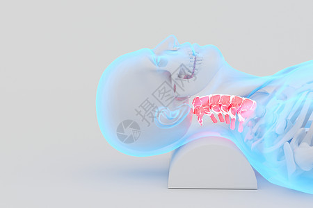 颈枕C4D颈椎疾病设计图片