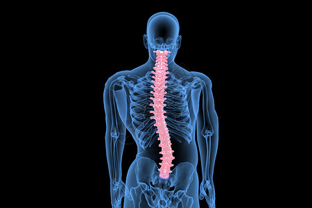 关节损伤C4D脊柱变形设计图片