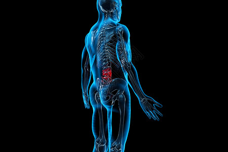 腰椎劳损3D腰椎疾病设计图片
