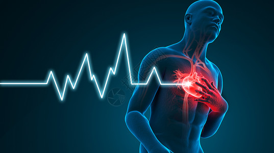 人体器官透视心脏病，冠心病，心肌梗塞场景设计图片
