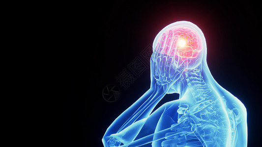 头颈癌3D脑部疾病设计图片