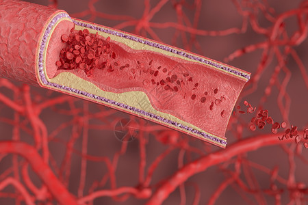 人体3D人体血管场景设计图片