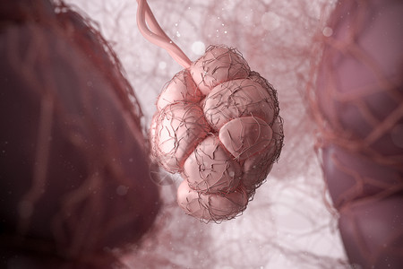 人体细胞肿瘤场景图片