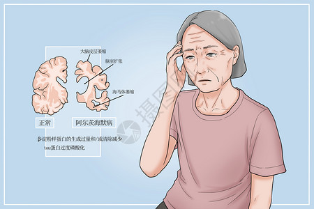 耳朵生病阿尔茨海默病病因医疗插画插画