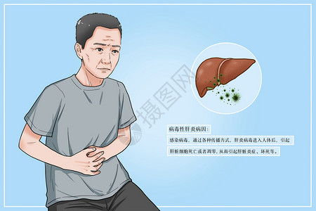 吃坏肚子病毒性肝炎病因医疗插画插画