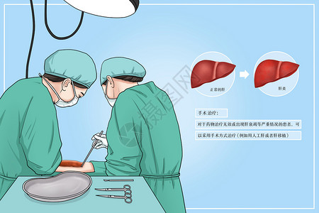 穿手术服思考的外科医生形象手术治疗肝炎医疗插画插画