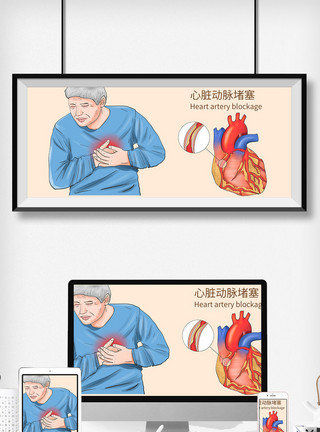 内科检查心脏动脉堵塞科普医疗插画模板