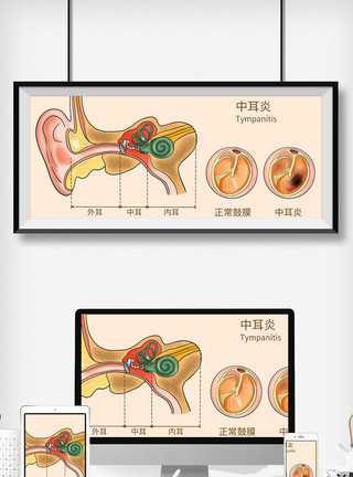 耳鼻咽喉科中耳炎科普医疗插画模板