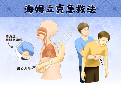 解食海姆立克急救法插画