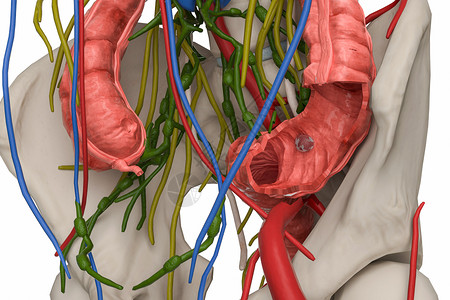 大肠癌场景人体结构大肠癌高清图片