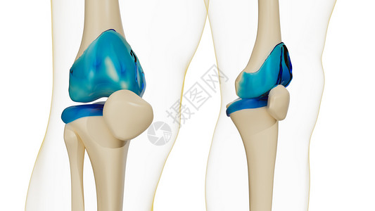 健康的膝关节-膝盖类风湿性关节炎图片素材