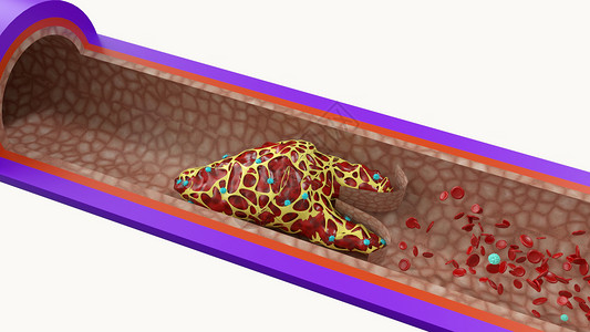 静脉血块人体结构细胞质高清图片