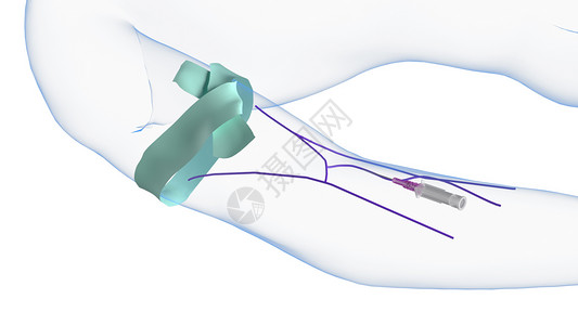 静脉注射插管插入背景图片
