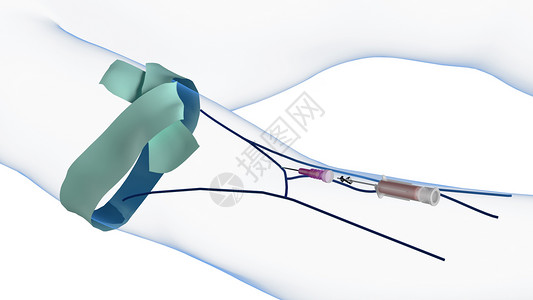 医疗针管针头注射器静脉注射针头取出设计图片