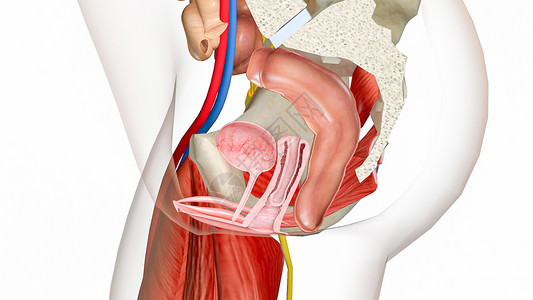 右内收肌大肌阴道金库脱垂2级设计图片