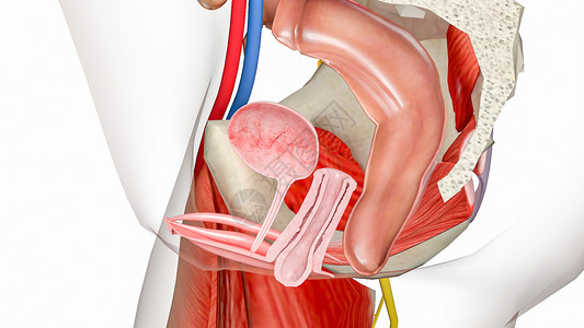 右内收肌大肌阴道金库脱垂3级设计图片