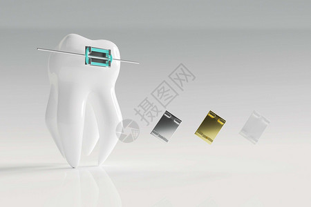 牙科器械三维牙齿矫正器械设计图片