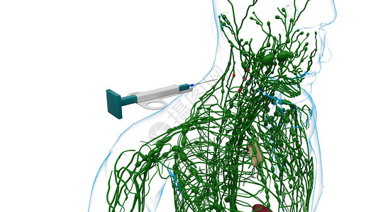穿刺活检淋巴结活检淋巴结吸取设计图片
