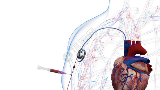 医疗导管静脉输液端口位置确认设计图片