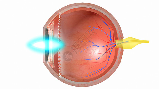右侧脉络膜眼部光路设计图片