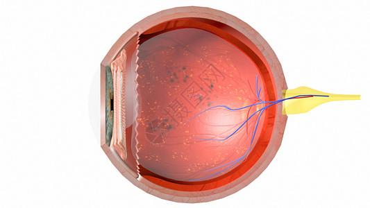 糖尿病眼横断面图片