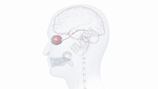 左巩膜视神经炎设计图片