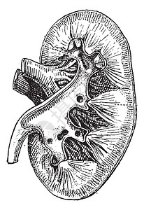 人的肾脏图片