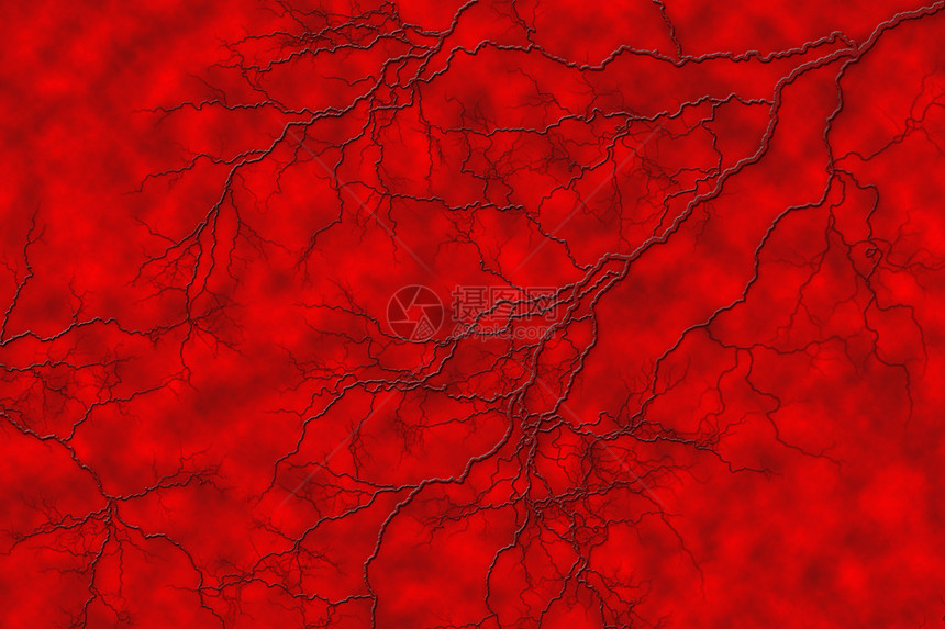 蜘蛛血管在像表面一样的血管上分流图片