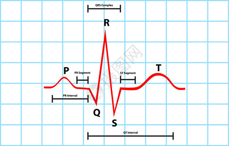 带有心电图的正常气态和脉冲脱极描述矢背景图片