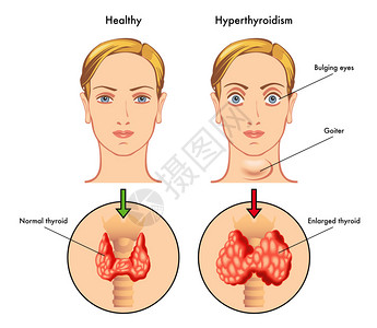 甲状腺解剖学图片