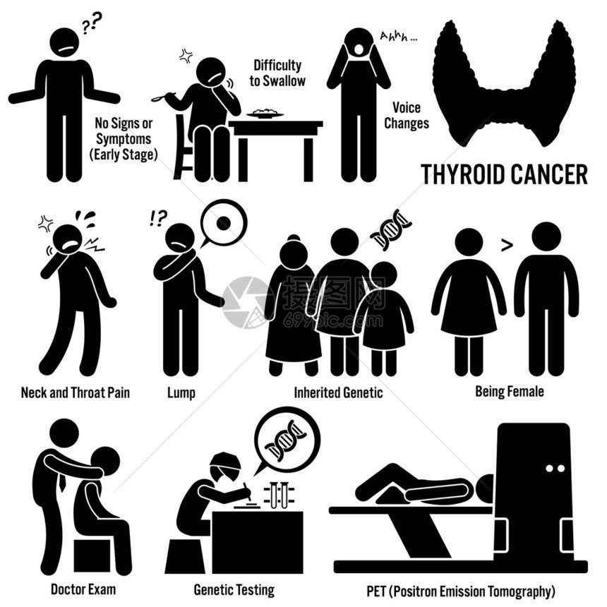 一组甲状腺癌疾病的插图图片