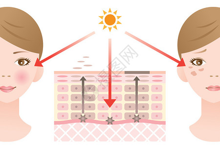 信息图表皮肤插图皮肤斑点机制图片