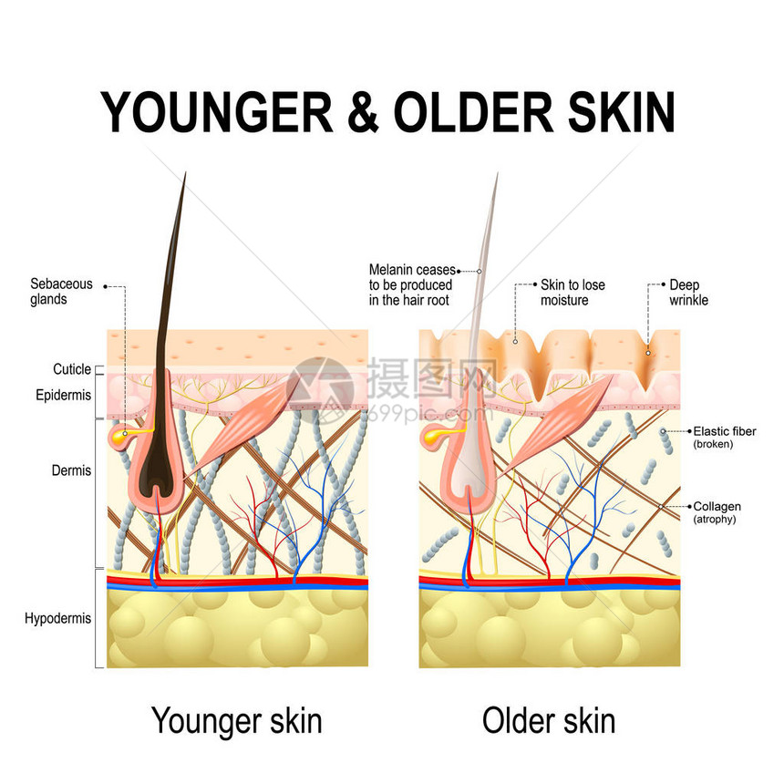 人体皮肤变化或皮肤老化图片