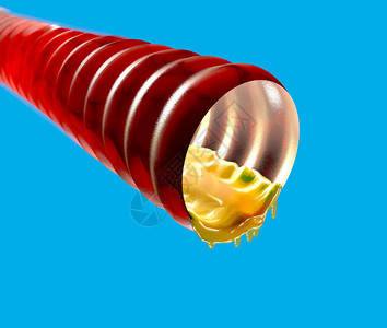吞咽气管粘液设计图片