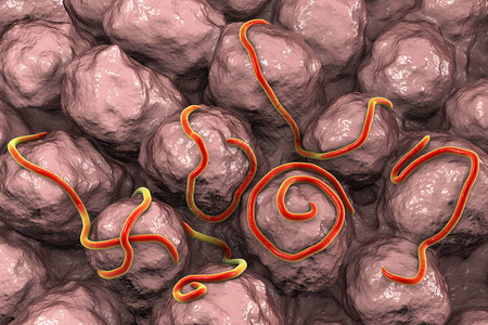外阴瘙痒肠胃中的螺旋线虫引起肠内丝虫的蠕虫设计图片