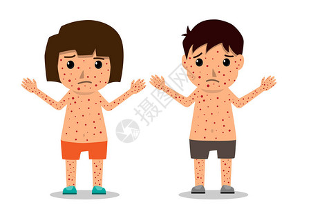 儿童有分布图海报儿童发烧和天花症状及预防图片