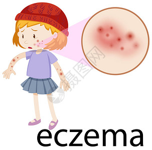 有放大的湿疹插图的小孩背景图片