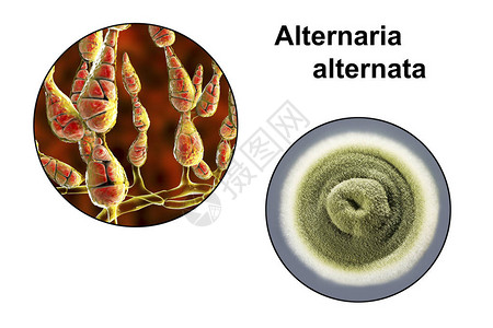 腐朽霉菌链格孢菌过敏真菌琼脂板上菌落的3D插图和照片链格孢是植物病害的病原体设计图片