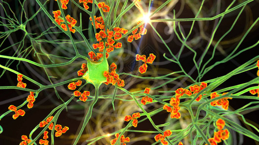 格林诺奇抗体攻击神经元3D插图自动免疫神设计图片