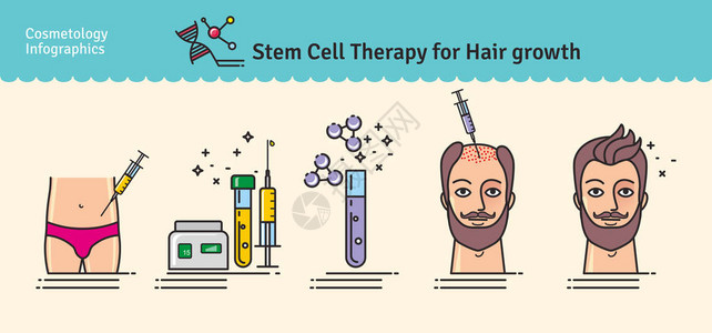 设置与毛发生长的干细胞治疗的矢量图解图片