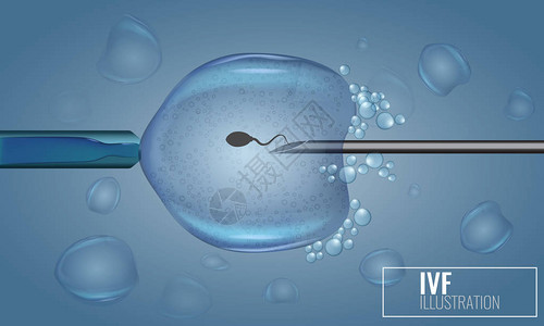 三不沾体外受精注射人工受精科学医病媒说明三设计图片