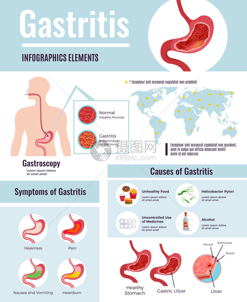 胃炎图表海报图片