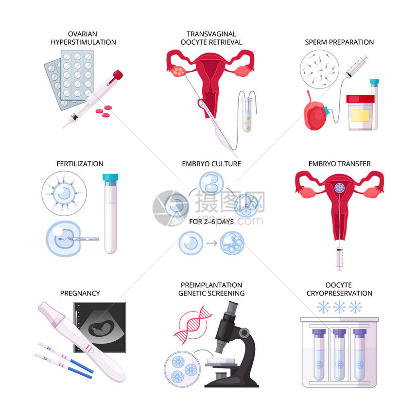 配有受孕胚胎培养转移和其他描述矢量插图的分离式平板体外受精图片
