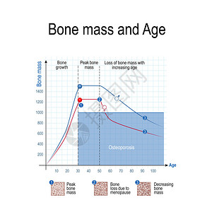 男和女骨量年龄和骨质疏松症图表健康的生活方式科学和医学用途矢量图图片