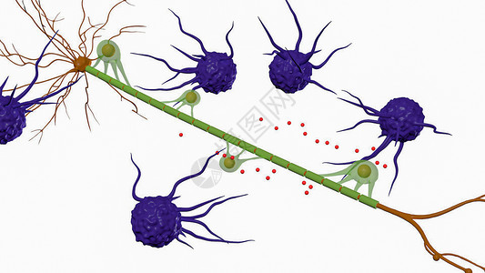 巨噬细胞对腱鞘的自身免疫攻击设计图片