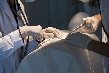 医学手术处女膜手术高清图片
