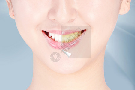护甲牙齿美白创意设计图片