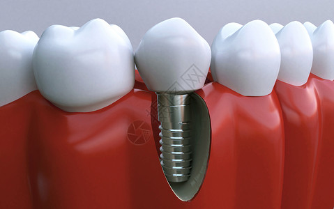 牙齿结构牙齿健康场景设计图片
