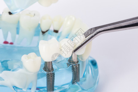 牙齿模型个护健康高清图片
