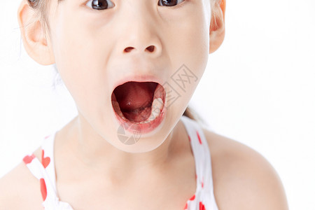小女孩张嘴巴检查牙齿背景图片